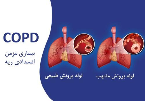 پمفلت COPD (بیماری انسدادی مزمن ریه)