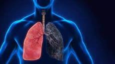 پاورپوینت COPD بیماریهای مزمن انسدادی ریه