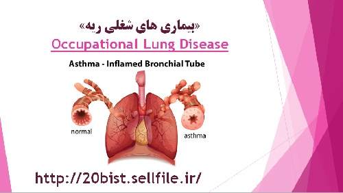 دانلود فایل پاورپوینت آماده و تخصصی در مورد بیماری های شغلی ریه ، Occupational Lung Disease