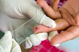 پاورپوینت مالاریا و روش تشخیص