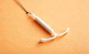 تحقیق IUD، روشی برای جلوگیری از حاملگی
