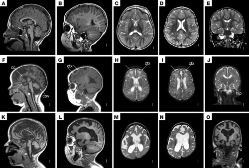  پاورپوینت آماده در مورد روش تصویربرداری MRI از سر و گردن