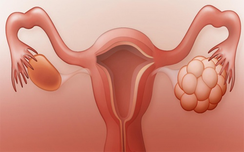  پاورپوینت ارائه مبحث تخمدان و هورمون های تخمدانی (Ovaries and ovarian hormones)