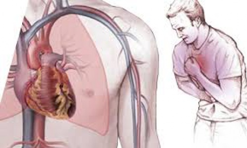  پاورپوینت دارو درمانی بیماری قلبی  عروقی آنژین صدری