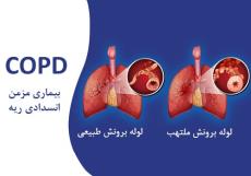 پمفلت COPD (بیماری انسدادی مزمن ریه)
