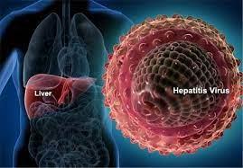 اسلاید آموزشی با عنوان هپاتیت های ویروسی