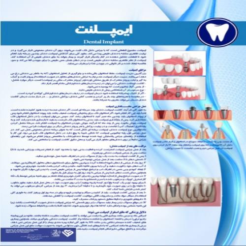  پوستر ایمپلنت دندان - مجموعه پوسترهای دندانپزشکی
