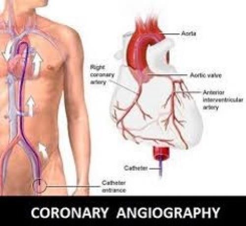  پاورپوینت برگزاری کارگاه و تدریس angiography( آموزش کامل آنژیوگرافی)