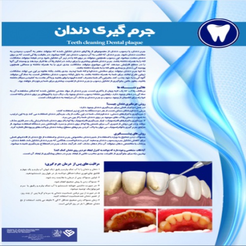  پوستر جرم گیری دندان- مجموعه پوسترهای دندانپزشکی