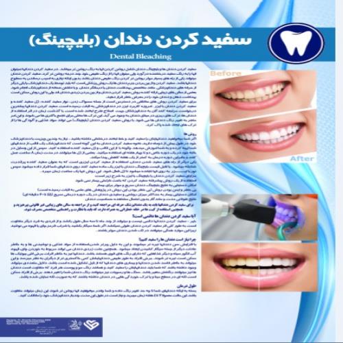  پوستر سفید کردن دندان بلیچینگ - مجموعه پوسترهای دندانپزشکی