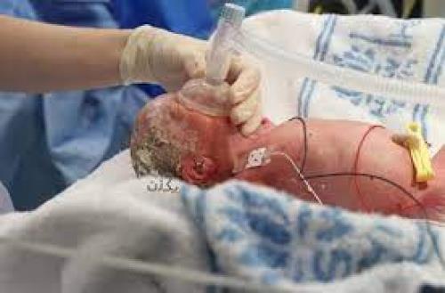  پاورپوینت آماده ارائه کنفرانس احیاء نوزادان (Neonatal resuscitation)