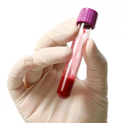 پاورپوینت کامل با عنوان انواع آزمایشات پزشکی خون 169 اسلاید