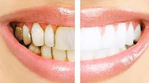 پاورپوینت مراقبت سلامت دهان و دندان