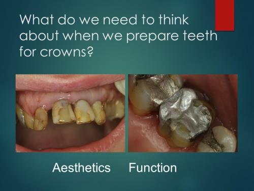  پاورپوینت تدریس اصول آماده سازی دندان(Principles of tooth preparation)