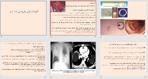  پاورپوينت با عنوان فارماکولوژی داروهای ضد کرم