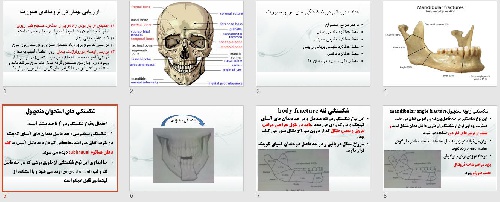  پاورپوينت با عنوان ارزیابی بیمار در تروماهای صورت