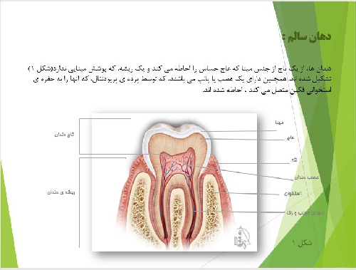  پاورپوينت با عنوان بهداشت دهان و دندان در افراد هموفیل و بیماران با اختلالات خونریزی دهنده ی ارثی
