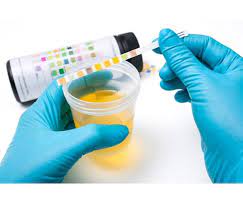 پاورپوینت Urine Analysis