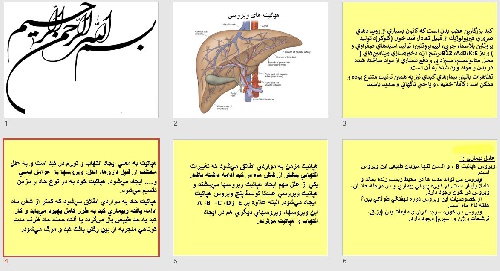  پاورپوينت با عنوان هپاتیت های ویروسی