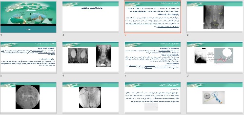   پاورپوينت با عنوان کلیات اورولوژی