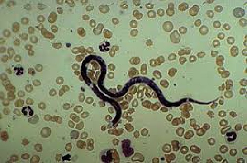  پاورپوینت شیستوزوما Schistosoma