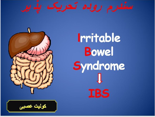  پاورپوينت با عنوان سندروم روده تحریک پذ یر