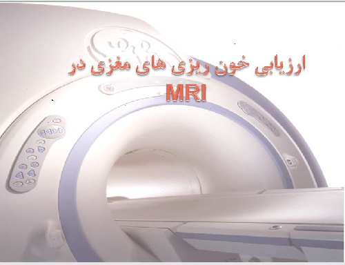  پاورپوينت با عنوان ارزیابی خون ریزی های مغزی در MRI