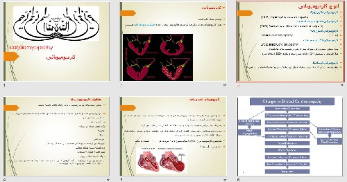  پاورپوينت با عنوان کاردیومیوپاتی cardiomyopathy