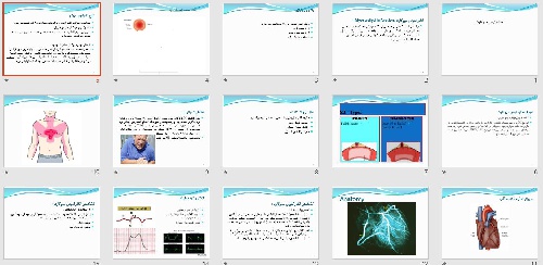  پاورپوينت با عنوان انفارکتوس میوکارد (Myocardiyal Infarction )