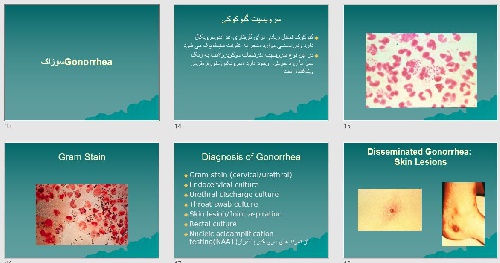   پاورپوينت با عنوان سرویسیت