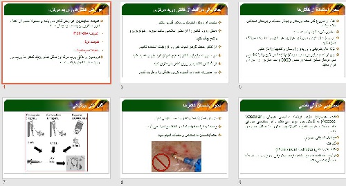  پاورپوينت با عنوان راههای دستیابی عروقی در همودیالیز