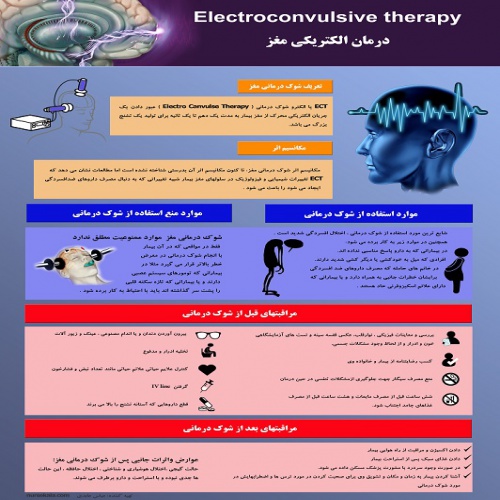  پوستر شوک درمانی یا درمان الکتریکی مغز ECT