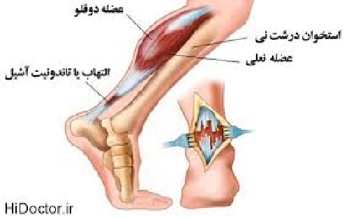  مقاله ای کامل در مورد پا