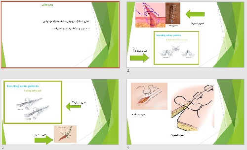  پاورپوينت با عنوان تصاویر شماتیک از بخیه زدن های متداول  در جراحی 